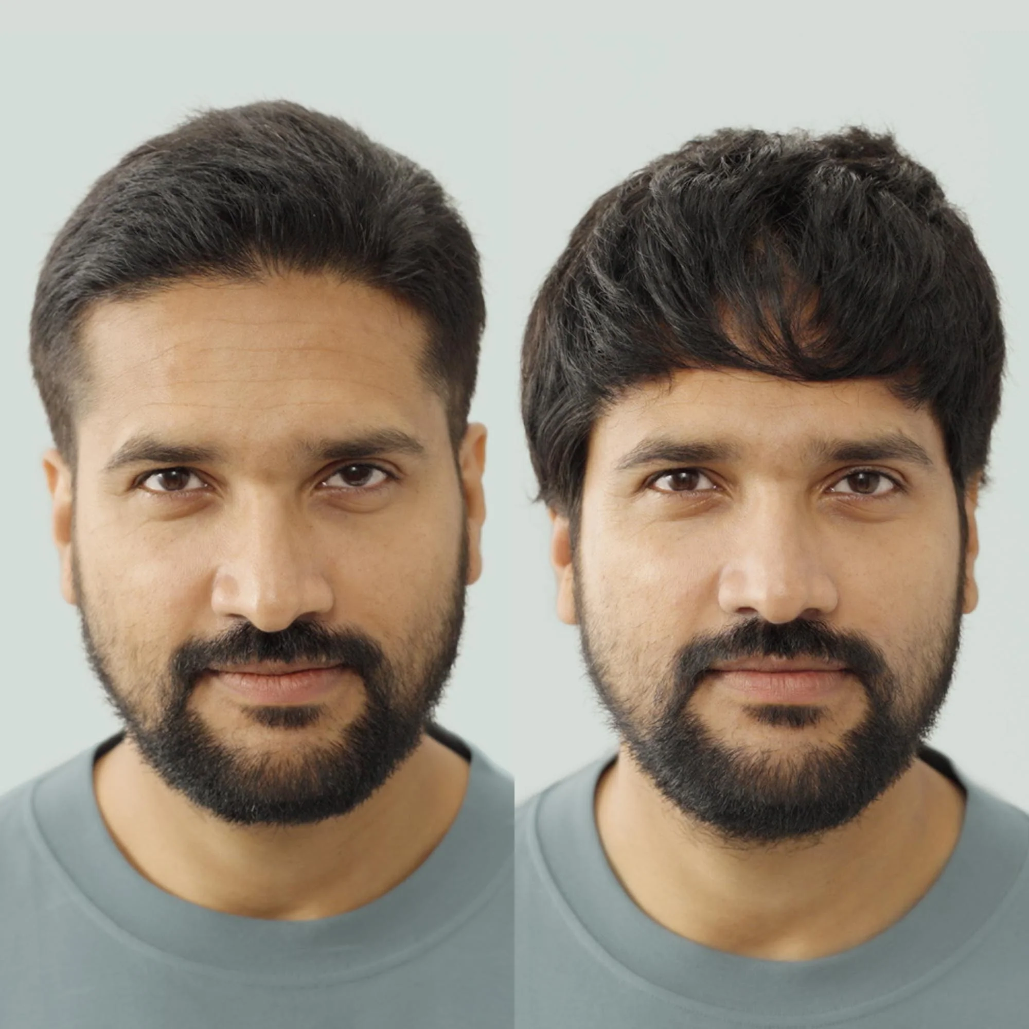 MultiShape Clipper Kit - Image 6